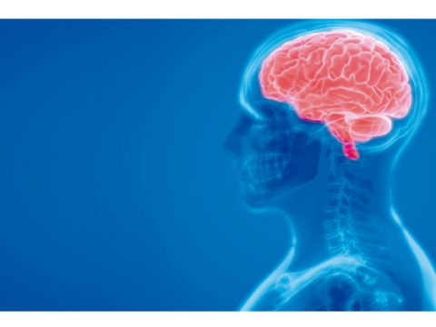 Ataque Cerebrovascular