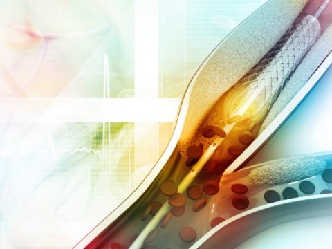 Especialidad Cirugía Vascular