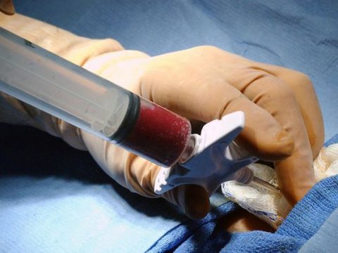 Servicio Unidad Trasplante de Médula Ósea