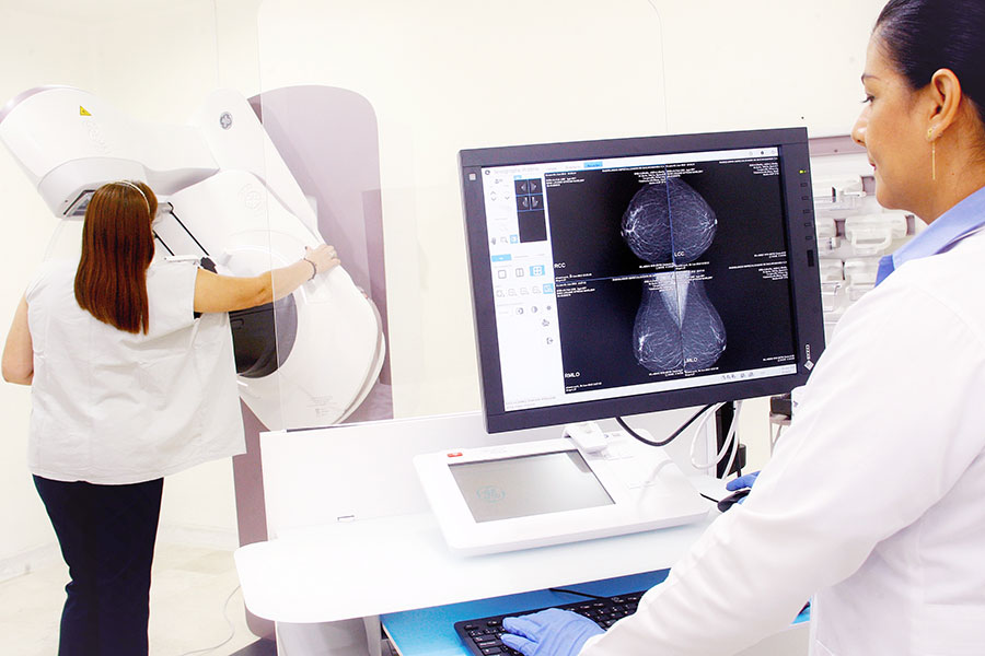 mamografia-digital-avances