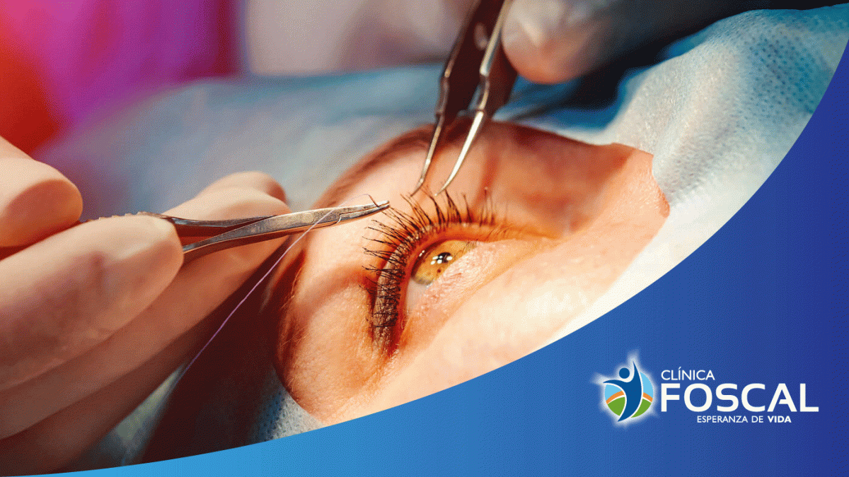 Oculoplastia, verse y sentirse bien