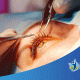 Oculoplastia, verse y sentirse bien