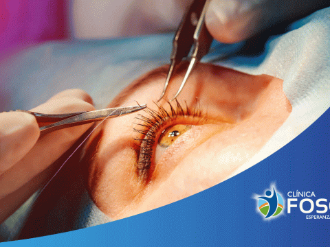 Oculoplastia, verse y sentirse bien