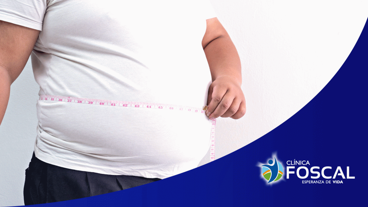 Cirugía bariátrica: un cambio de apariencia que puede salvar vidas