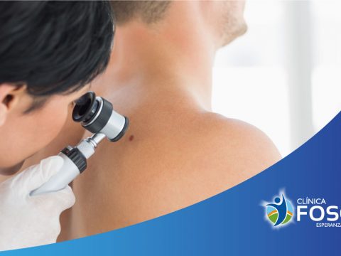 Preguntas y respuestas sobre el cáncer de piel